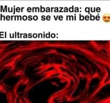 el ultrasonido...prros.jpg